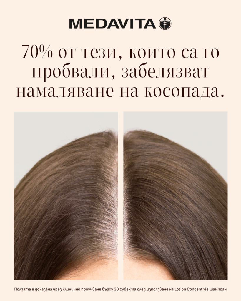 02 (1) лечение на силен косопад с Lotion Concentree